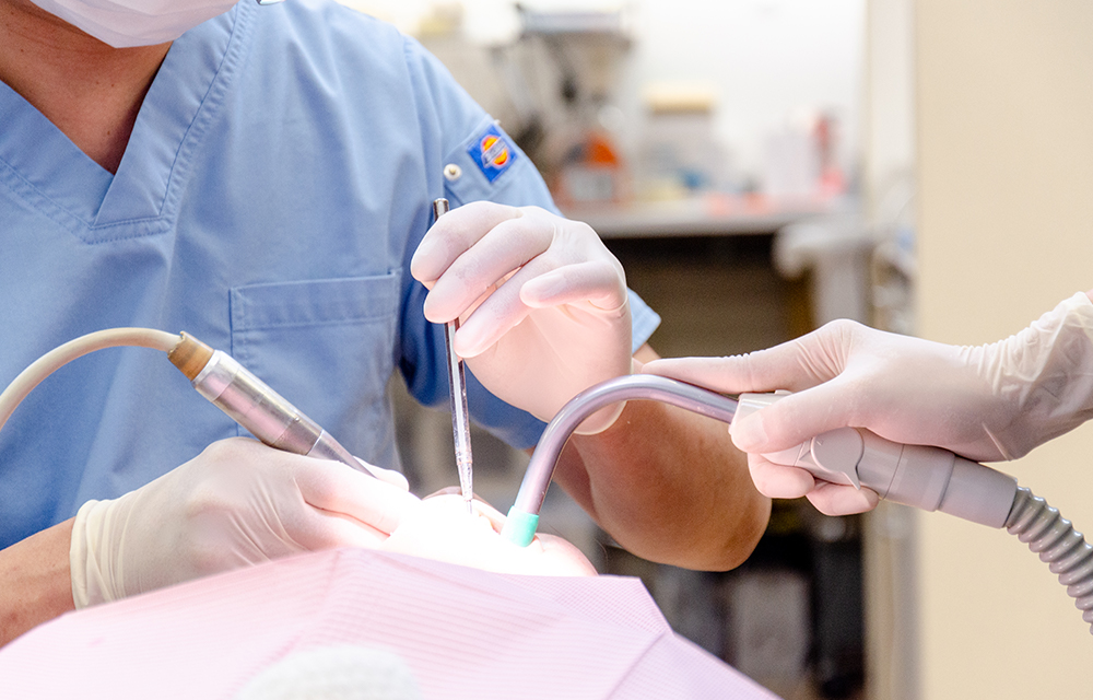 一般歯科治療イメージ