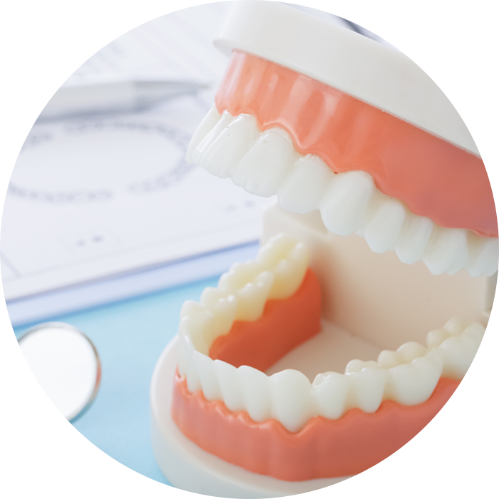 インプラントイメージ
